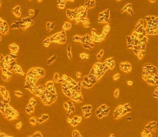 肝癌研究的潜在新突破