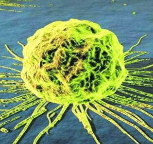 如何扼住癌症生长？