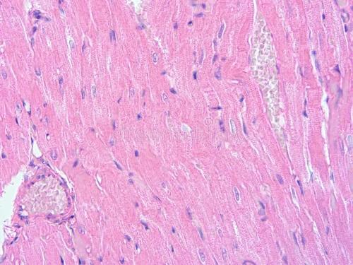 一条小鱼提供重建受损心脏组织的线索