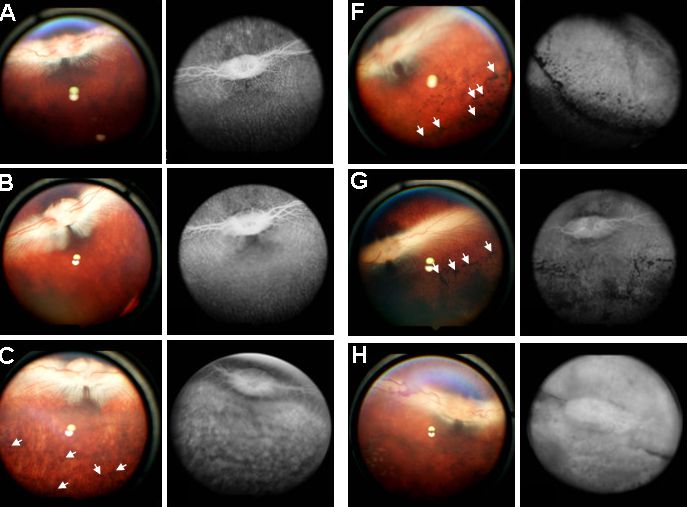 【动物造模】-兔单眼局限性感光细胞变性模型