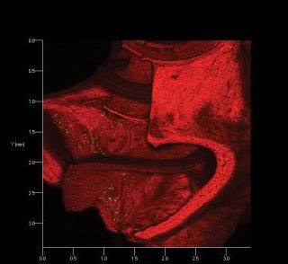 【动物造模】-人工耳蜗植入可以采用基因疗法
