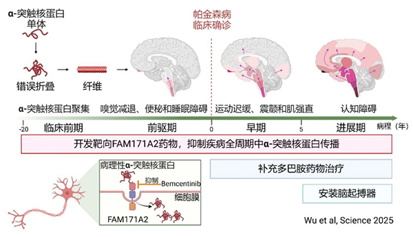 我国学者在帕金森病发病机制研究方面取得进展