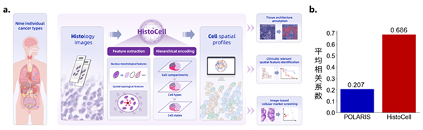 我国学者在肿瘤病理影像微观信息解析算法方面取得突破