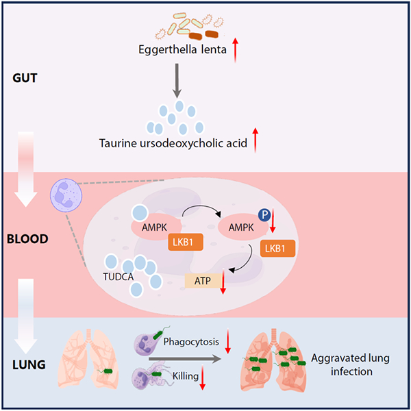 我国学者在支气管扩张症患者“肠-肺轴”研究方面取得进展