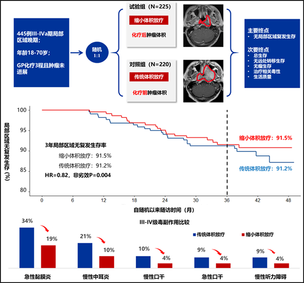 我国学者在鼻咽癌“减毒”放疗研究方面取得进展