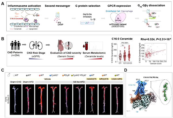 我国学者在神经酰胺受体调控动脉粥样硬化机制研究方面取得进展