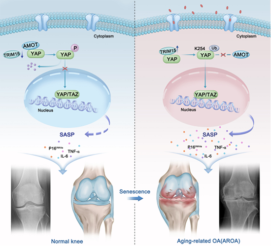 我国学者在细胞衰老促进骨关节炎形成研究方面取得进展