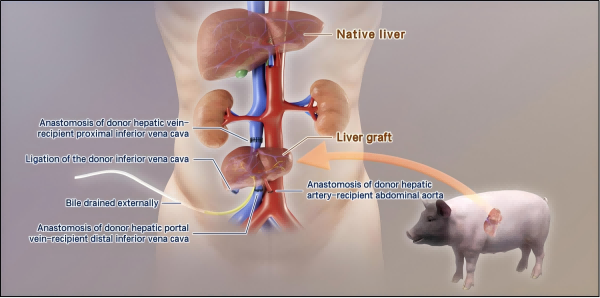 我国学者在异种肝移植方面取得进展