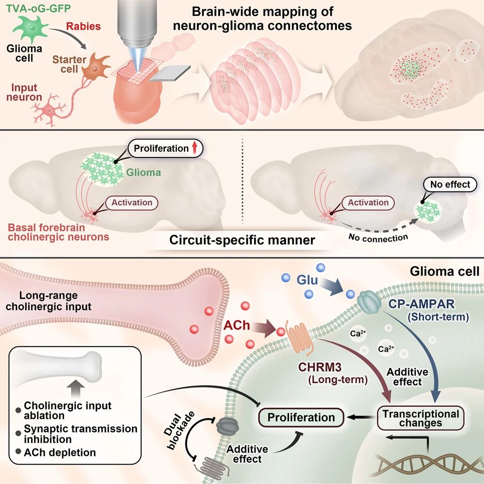 Cancer Cell｜卞修武院士团队破解脑瘤“遥控”新机制